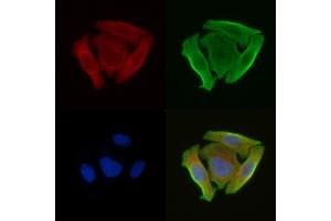 ABIN6258540 and ABIN6274879 staining Hela cells(30 min of UV treatment) by IF/ICC.