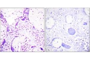 Immunohistochemistry analysis of paraffin-embedded human placenta tissue, using PPAR-gamma (Ab-112) Antibody. (PPARG 抗体  (AA 78-127))