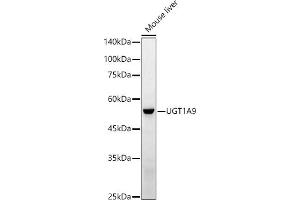 Western blot analysis of extracts of Mouse liver, using UGT1 antibody (ABIN3022342, ABIN3022343, ABIN3022344 and ABIN6218752) at 1:1000 dilution. (UGT1A9 抗体  (AA 26-250))