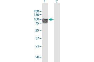 Western Blot analysis of OPA1 expression in transfected 293T cell line by OPA1 monoclonal antibody (M02), clone 8A20. (OPA1 抗体  (AA 851-960))