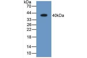 Detection of Recombinant ARL1, Human using Polyclonal Antibody to Aldose Reductase Like Protein 1 (ARL1) (ARL1 抗体  (AA 1-316))