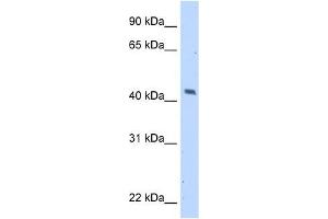 MAGEA1 antibody used at 5 ug/ml to detect target protein. (MAGEA1 抗体)