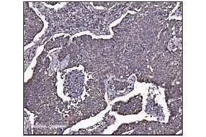 IHC analysis of FABP-1/GOT2 using anti-FABP-1/GOT2 antibody (ABIN7601426). (GOT2 抗体  (AA 35-430))