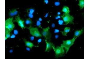 Anti-DOK7 mouse monoclonal antibody (ABIN2455827) immunofluorescent staining of COS7 cells transiently transfected by pCMV6-ENTRY DOK7 (RC219267). (DOK7 抗体)