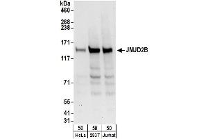 Western Blotting (WB) image for anti-Lysine (K)-Specific Demethylase 4B (KDM4B) (AA 1056-1096) antibody (ABIN7451825) (KDM4B 抗体  (AA 1056-1096))