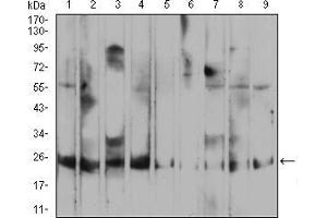 Western Blotting (WB) image for anti-Ras-related Protein Ral-A (rala) (AA 71-203) antibody (ABIN5876697) (rala 抗体  (AA 71-203))
