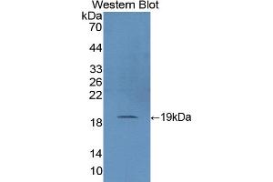 Detection of Recombinant SOD1, Pig using Polyclonal Antibody to Superoxide Dismutase 1 (SOD1) (SOD1 抗体  (AA 2-153))