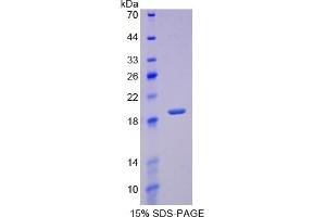 SDS-PAGE of Protein Standard from the Kit (Highly purified E. (REG3g ELISA 试剂盒)
