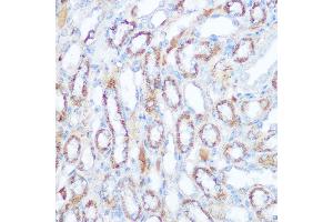Immunohistochemistry (IHC) image for anti-Sirtuin 4 (SIRT4) (AA 29-260) antibody (ABIN6147796)