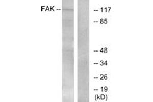 Western blot analysis of extracts from Jurkat cells, treated with CD3 antibody, using FAK (Ab-397) Antibody. (FAK 抗体  (AA 364-413))