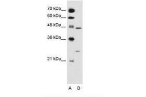 Image no. 1 for anti-Retinoid X Receptor, gamma (RXRG) (AA 101-150) antibody (ABIN6736682) (Retinoid X Receptor gamma 抗体  (AA 101-150))