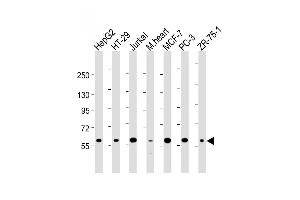 All lanes : Anti-DCLRE1C Antibody (N-term) at 1:2000 dilution Lane 1: HepG2 whole cell lysate Lane 2: HT-29 whole cell lysate Lane 3: Jurkat whole cell lysate Lane 4: mouse heart lysate Lane 5: MCF-7 whole cell lysate Lane 5: PC-3 whole cell lysate Lane 5: ZR-75-1 whole cell lysate Lysates/proteins at 20 μg per lane. (DCLRE1C 抗体  (N-Term))