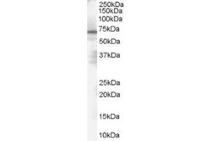 Image no. 1 for anti-Poly (ADP-Ribose) Polymerase 2 (PARP2) (Internal Region) antibody (ABIN374644) (PARP2 抗体  (Internal Region))