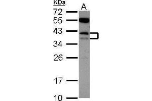 WB Image Sample (30 ug of whole cell lysate) A: K562 12% SDS PAGE antibody diluted at 1:1000 (CD79b 抗体  (Center))