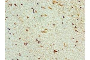 Immunohistochemistry of paraffin-embedded human brain tissue using ABIN7168991 at dilution of 1:100 (STK32A 抗体  (AA 1-166))