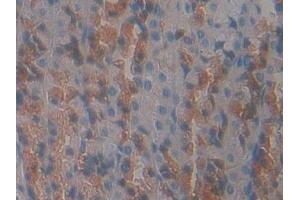 Immunohistochemistry (IHC) image for anti-Growth Hormone Receptor (GHR) (AA 353-588) antibody (ABIN7442081)