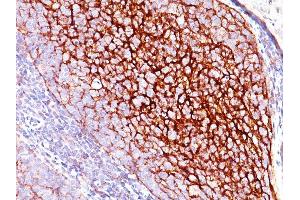Formalin-fixed, paraffin-embedded human Tonsil stained with CD35 Mouse Monoclonal Antibody (E11). (CD35 抗体)