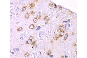 Immunohistochemistry of paraffin-embedded Rat brain using RPS3A Polyclonal Antibody at dilution of 1:100 (40x lens). (RPS3A 抗体)