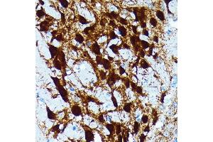 Immunohistochemistry of paraffin-embedded mouse brain using Parvalbumin (PVALB) (PVALB) Rabbit mAb (ABIN7269182) at dilution of 1:100 (40x lens). (PVALB 抗体)