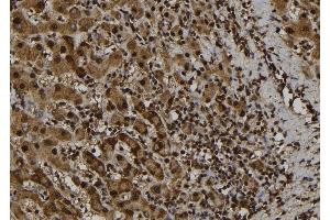 ABIN6277753 at 1/100 staining Human liver tissue by IHC-P. (PYDC1 抗体)