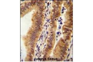 Immunohistochemistry (Paraffin-embedded Sections) (IHC (p)) image for anti-MTOR associated protein, eak-7 homolog (MEAK7) (AA 426-456), (C-Term) antibody (ABIN654471)