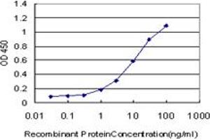 Detection limit for recombinant GST tagged ERN1 is approximately 0. (ERN1 抗体  (AA 401-500))