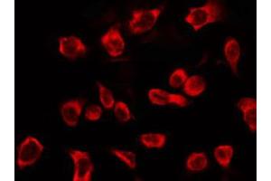 anti-Keratin 16 (KRT16) (C-Term) antibody