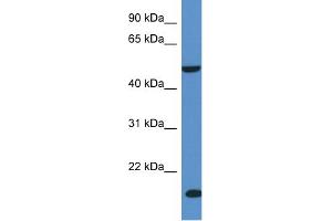 WB Suggested Anti-INPP5K Antibody Titration: 1. (INPP5K 抗体  (C-Term))