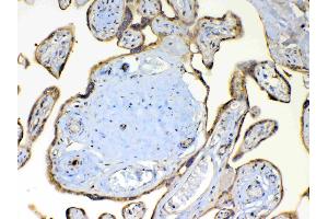 IHC analysis of TSPAN12 using anti-TSPAN12 antibody .