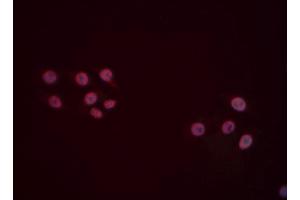 ABIN6277494 staining Hela cells by IF/ICC. (FOXP1 抗体  (C-Term))