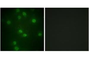 Immunofluorescence analysis of HuvEc cells, using Retinoblastoma (Phospho-Ser811) Antibody. (Retinoblastoma Protein (Rb) 抗体  (pSer811))