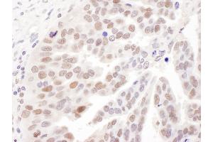 Immunohistochemistry (IHC) image for anti-Polymerase (DNA Directed), delta 1, Catalytic Subunit 125kDa (POLD1) (AA 50-100) antibody (ABIN7453541)