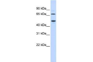 Western Blotting (WB) image for anti-Tryptophan 2,3-Dioxygenase (TDO2) (N-Term) antibody (ABIN2782334)