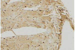 ABIN6274722 at 1/100 staining Mouse muscle tissue by IHC-P. (MRPS7 抗体)