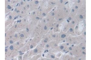 Detection of STIP1 in Human Liver Tissue using Polyclonal Antibody to Stress Induced Phosphoprotein 1 (STIP1) (STIP1 抗体  (AA 1-169))