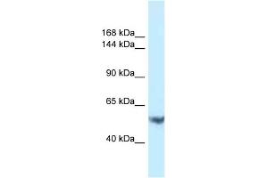 Host: Rabbit Target Name: EPHA1 Sample Type: PANC1 Whole Cell lysates Antibody Dilution: 1. (EPHA1 抗体  (C-Term))