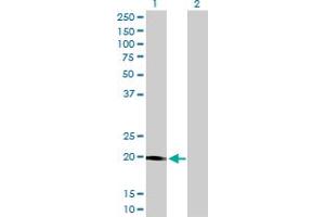 Western Blot analysis of STK32A expression in transfected 293T cell line by STK32A monoclonal antibody (M01), clone 3E8-1D3. (STK32A 抗体  (AA 1-166))