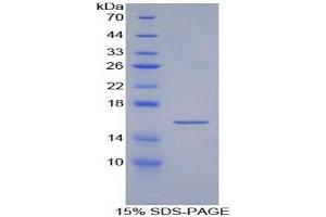 SDS-PAGE analysis of Artemin Protein. (ARTN 蛋白)