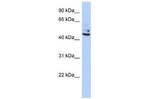 Western Blot showing TP53I13 antibody used at a concentration of 1-2 ug/ml to detect its target protein. (TP53I13 抗体  (Middle Region))