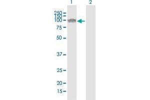 Western Blot analysis of NLGN1 expression in transfected 293T cell line by NLGN1 polyclonal antibody (A01). (Neuroligin 1 抗体  (AA 578-677))