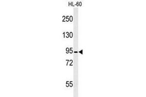 Western blot analysis of CAPN3 Antibody (C-term) in HL-60 cell line lysates (35µg/lane). (Calpain 3 抗体  (C-Term))