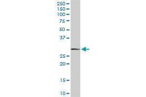 Western Blotting (WB) image for anti-Melanoma Antigen Family A, 9 (MAGEA9) (AA 1-315) antibody (ABIN517698)