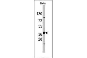 Image no. 1 for anti-Ectodysplasin A (EDA) (N-Term) antibody (ABIN358789) (Ectodysplasin A 抗体  (N-Term))