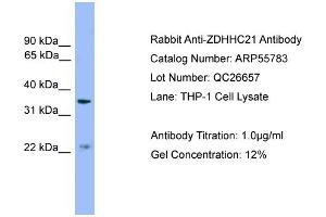 Western Blotting (WB) image for anti-Zinc Finger, DHHC-Type Containing 21 (ZDHHC21) (Middle Region) antibody (ABIN2786363)