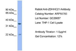 WB Suggested Anti-ZDHHC21  Antibody Titration: 0. (ZDHHC21 抗体  (Middle Region))