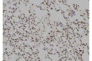 ABIN6264812 and ABIN6279377 at 1/100 staining Rat lung tissue by IHC-P.