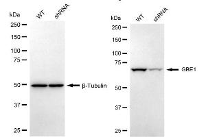 Western blotting analysis using GBE1 antibody (ABIN7798727). (GBE1 抗体)