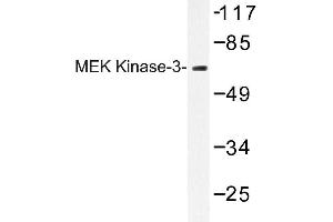 Image no. 1 for anti-Mitogen-Activated Protein Kinase Kinase 3 (MAP2K3) antibody (ABIN272249) (MAP2K3 抗体)
