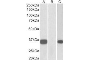 Western Blotting (WB) image for anti-Abhydrolase Domain Containing 14B (ABHD14B) (Internal Region) antibody (ABIN2465095) (ABHD14B 抗体  (Internal Region))