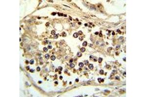 IHC analysis of FFPE human testis tissue stained with ABHD12 antibody (ABHD12 抗体  (AA 40-66))